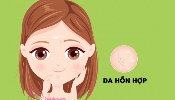 Da hỗn hợp thiên dầu là gì, làm sao để chăm sóc hiệu quả