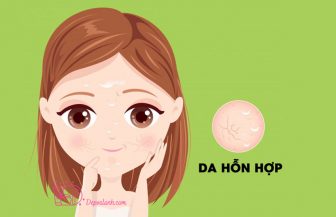 Da hỗn hợp thiên dầu là gì, làm sao để chăm sóc hiệu quả